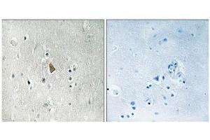 Immunohistochemical analysis of paraffin-embedded human brain tissue using IGF1R (Phospho-Tyr1346) antibody (left)or the same antibody preincubated with blocking peptide (right). (IGF1R antibody  (pTyr1346))