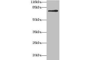Western blot All lanes: MTHFR antibody at 2 μg/mL + 293T whole cell lysate Secondary Goat polyclonal to rabbit IgG at 1/10000 dilution Predicted band size: 75, 79 kDa Observed band size: 75 kDa