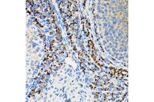 Immunohistochemistry of paraffin-embedded rat ovary using SRP19 antibody.