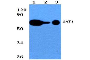 Western blot  analysis of SLC22A6 / OAT1 Antibody at 1/500 dilution. (SLC22A6 antibody)