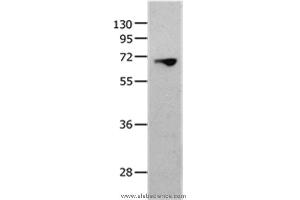 Western blot analysis of 823 cell, using MMP25 Polyclonal Antibody at dilution of 1:1300 (MMP25 antibody)