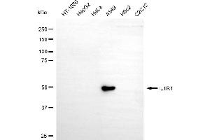 Western blotting analysis using IL1R1 antibody (ABIN7799095).