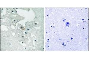 Immunohistochemistry analysis of paraffin-embedded human brain, using BLNK (Phospho-Tyr84) Antibody. (B-Cell Linker antibody  (pTyr84))