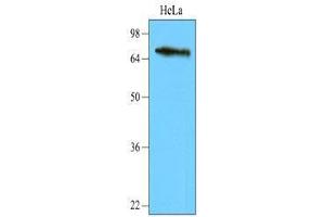 Cell lysates of HeLa (40 ug) were resolved by SDS-PAGE, transferred to nitrocellulose membrane and probed with anti-human NSD3 (1:2,000). (WHSC1L1 antibody  (AA 383-660))