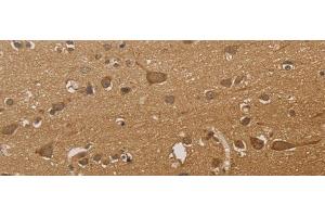Immunohistochemistry of paraffin-embedded Human brain tissue using CSNK2B Polyclonal Antibody at dilution of 1:30(x200) (CSNK2B antibody)