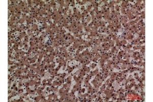 Immunohistochemistry (IHC) image for anti-Adrenomedullin (ADM) (Internal Region) antibody (ABIN3187738)
