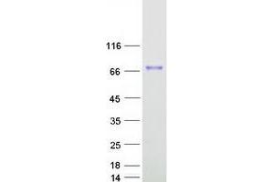 CIRH1A Protein (Myc-DYKDDDDK Tag)