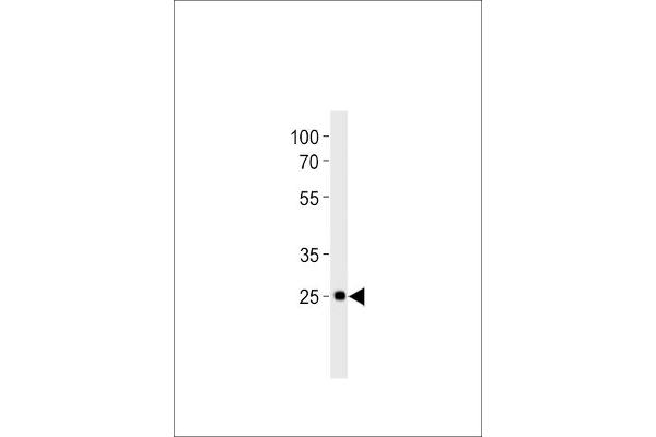 DLX6 Antikörper  (C-Term)