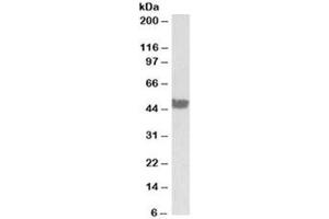 Western blot testing of human colon lysate with CK20 antibody at 0. (KRT20 antibody)