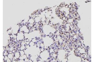ABIN6269341 at 1/100 staining Mouse lung tissue by IHC-P. (Acetyl-CoA Carboxylase alpha antibody  (N-Term))