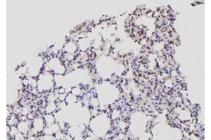 ABIN6269341 at 1/100 staining Mouse lung tissue by IHC-P.