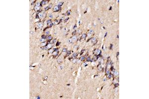 IHC analysis of GPR54/KISS1R using anti-GPR54/KISS1R antibody (ABIN7602153). (KISS1R antibody  (AA 60-373))