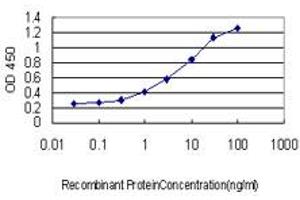 Detection limit for recombinant GST tagged FOXO1A is approximately 0. (FOXO1 antibody  (AA 556-655))