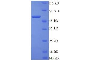 SDS-PAGE (SDS) image for Tyrosinase-Related Protein 1 (TYRP1) (AA 82-333), (partial) protein (GST tag) (ABIN4976547)
