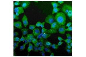 anti-Niemann-Pick Disease, Type C2 (NPC2) (AA 20-151) antibody