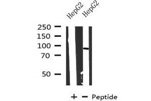 Western blot analysis on HepG2 cells lysate using CPT1A antibody (CPT1A antibody  (Internal Region))