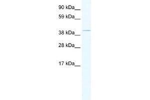 WB Suggested Anti-TAF7L Antibody Titration:  1. (TAF7L antibody  (Middle Region))