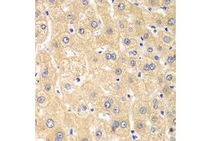 Immunohistochemistry of paraffin-embedded human liver injury using IMPA1 antibody at dilution of 1:100 (x40 lens). (IMPA1 antibody)