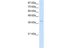 Western Blotting (WB) image for anti-Protein Arginine Methyltransferase 1 (PRMT1) antibody (ABIN2462043) (PRMT1 antibody)