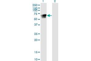 Western Blot analysis of GRB7 expression in transfected 293T cell line by GRB7 monoclonal antibody (M03), clone 3C12. (GRB7 antibody  (AA 37-136))