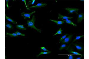 Immunofluorescence of purified MaxPab antibody to TRIT1 on HeLa cell. (TRIT1 antibody  (AA 1-467))