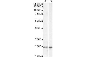ABIN184805 (2µg/ml) staining of HEK293 (A) and HeLa (B) cell lysate (35µg protein in RIPA buffer). (UBE2C antibody  (C-Term))