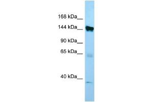 WB Suggested Anti-EMILIN1 Antibody Titration: 1. (Emilin1 antibody  (C-Term))