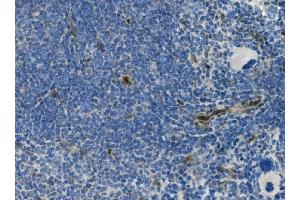 IHC analysis of MCAM using anti-MCAM antibody (ABIN7601026). (MCAM antibody  (AA 27-621))