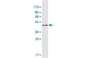 Western Blot detection against Immunogen (41 KDa) . (AKR1CL1 antibody  (AA 1-129))