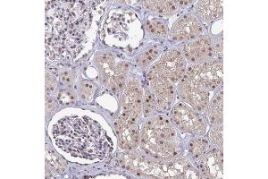 Immunohistochemical staining of human kidney with ATF1 polyclonal antibody  shows moderate nuclear positivity in renal tubules and cells in glomeruli. (AFT1 antibody)