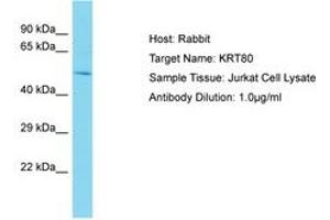 Image no. 1 for anti-Keratin 80 (KRT80) (AA 57-106) antibody (ABIN6750577) (KRT80 antibody  (AA 57-106))