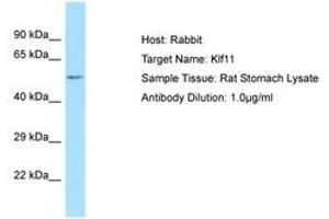 Image no. 1 for anti-Kruppel-Like Factor 11 (KLF11) (N-Term) antibody (ABIN6749845) (KLF11 antibody  (N-Term))