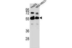 Western Blotting (WB) image for anti-RAP1, GTP-GDP Dissociation Stimulator 1 (RAP1GDS1) antibody (ABIN2996449)