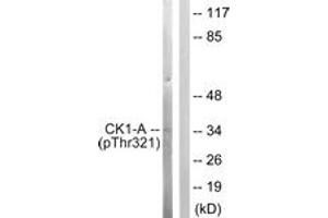 Western blot analysis of extracts from HuvEc cells, using Casein Kinase I alpha (Phospho-Tyr321) Antibody. (CSNK1A1 antibody  (pThr321))