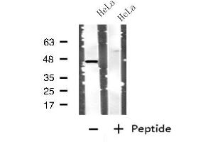 Western blot analysis of extracts from HeLa cells, using CTSD antibody. (Cathepsin D antibody  (C-Term))