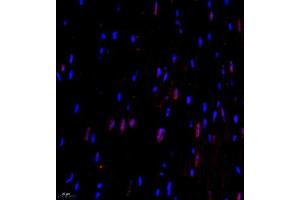 Immunofluorescence of paraffin embedded mouse heart using CITED4 (ABIN7073356) at dilution of 1:2200 (400x lens) (CITED4 antibody)