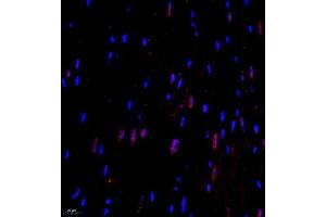 Immunofluorescence of paraffin embedded mouse heart using CITED4 (ABIN7073356) at dilution of 1:2200 (400x lens) (CITED4 antibody)