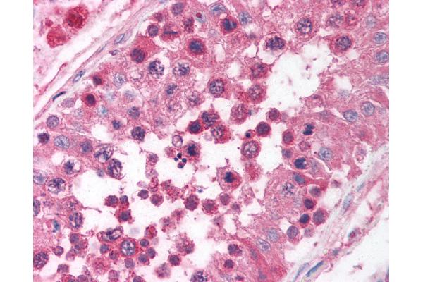 EGR4 antibody  (C-Term)