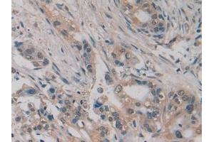 Immunohistochemistry (IHC) image for anti-Slit Homolog 2 (Drosophila) (SLIT2) (AA 1416-1528) antibody (ABIN7438007)