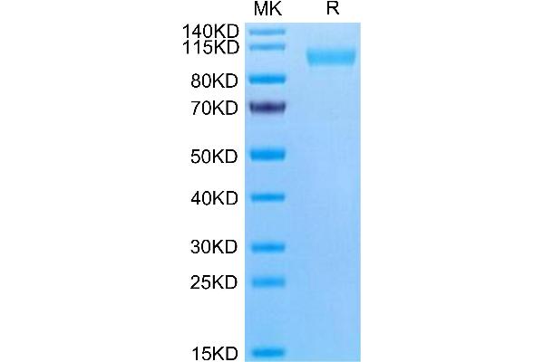 PTGFRN Protein (AA 26-832) (His tag)