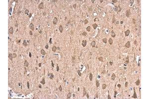 IHC-P Image HSP70 1A antibody detects HSP70 1A protein at cytoplasm in rat brain by immunohistochemical analysis. (HSP70 1A antibody  (Center))