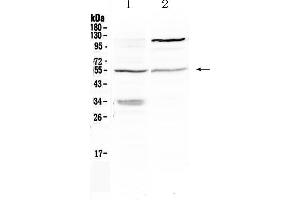 Western blot analysis of ETS1 using anti- ETS1 antibody . (ETS1 antibody  (N-Term))