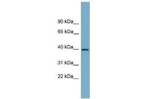 SULT2B1 antibody used at 1 ug/ml to detect target protein. (SULT2B1 antibody  (N-Term))