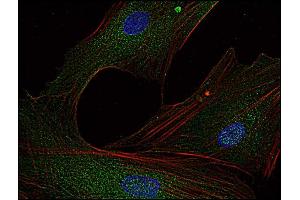 Immunofluorescence staining of Fyn in human primary fibroblasts using anti-Fyn (; green). (FYN antibody  (AA 7-176))