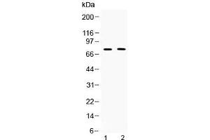 Western blot testing of 1) rat thymus and 2) human COLO320 lysate with TRF2 antibody at 0.