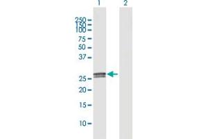 Western Blot analysis of C1QA expression in transfected 293T cell line by C1QA MaxPab polyclonal antibody. (C1QA antibody  (AA 1-245))