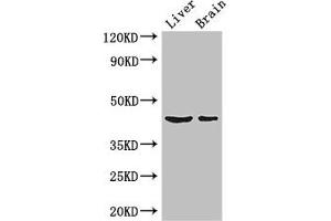 Western Blot Positive WB detected in: Mouse liver tissue, Mouse brain tissue All lanes: METTL2A antibody at 3 μg/mL Secondary Goat polyclonal to rabbit IgG at 1/50000 dilution Predicted band size: 44, 28 kDa Observed band size: 44 kDa (METTL2A antibody  (AA 1-242))