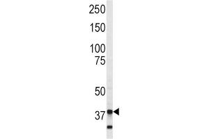 Western Blotting (WB) image for anti-Annexin A5 (ANXA5) (AA 262-291) antibody (ABIN3002694) (Annexin V antibody  (AA 262-291))