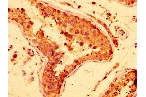 IHC image of ABIN7158070 diluted at 1:300 and staining in paraffin-embedded human testis tissue performed on a Leica BondTM system. (LRRFIP2 antibody  (AA 211-342))