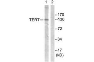 Western blot analysis of extracts from Jurkat cells, using Telomerase (Ab-824) Antibody. (TERT antibody  (AA 796-845))